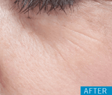 Skin Moisture Lock (60 Caps)