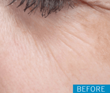 Skin Moisture Lock (60 Caps)