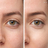 Active Light® Under-eye Concealer