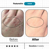 Skin Omegas+ (180 Caps)